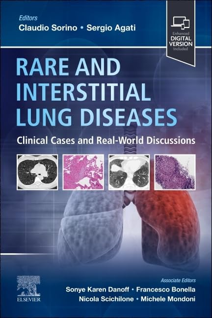 Rare and Interstitial Lung Diseases: Clinical Cases and Real-World Discussions 2025