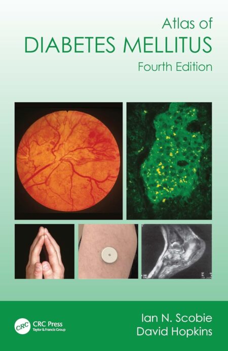 Atlas of Diabetes Mellitus 4/E 2024