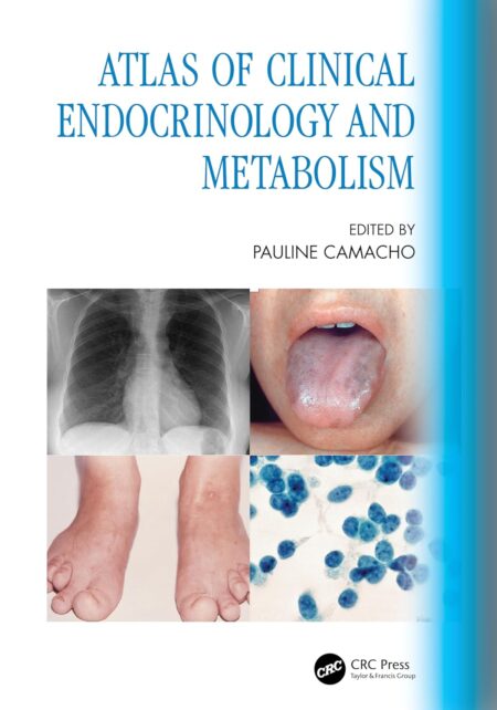 Atlas of Clinical Endocrinology and Metabolism 2024