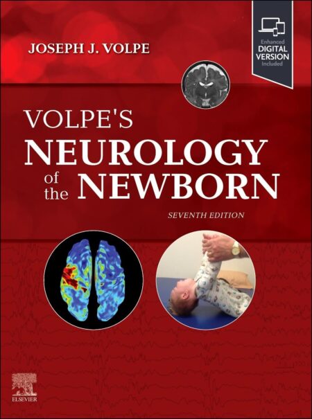 Volpes Neurology of the Newborn 7/E 2025