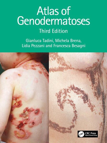 Atlas of Genodermatoses 3/E 2024