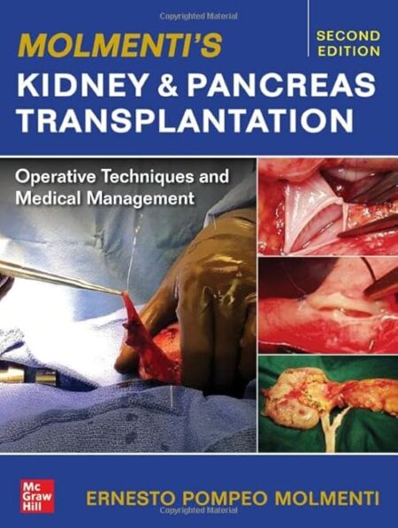 Molmentis Kidney and Pancreas Transplantation: Operative Techniques and Medical Management 2/E 2023