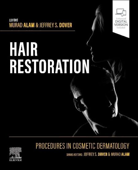 Procedures in Cosmetic Dermatology: Hair Restoration 2024