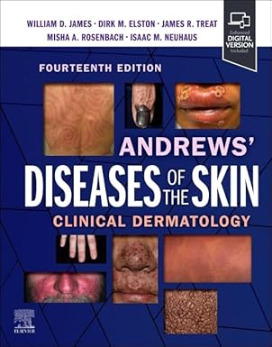 Andrews' Diseases of the Skin: Clinical Dermatology 14th 版本