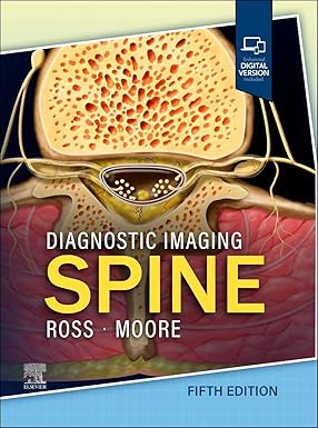 Diagnostic Imaging: Spine 5/E