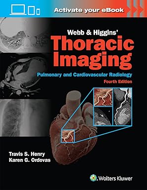 Webb & Higgins Thoracic Imaging: Print + eBook with Multimedia 第四 版本