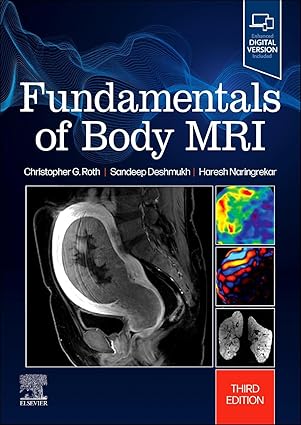 Fundamentals of Body MRI (Fundamentals of Radiology) 3rd 版