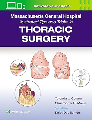 Massachusetts General Hospital Illustrated Tips and Tricks in Thoracic Surgery: Print + eBook with Multimedia First Edition