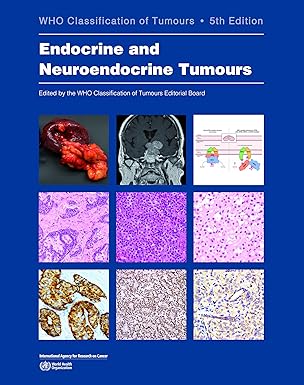 Endocrine and Neuroendocrine Tumours: WHO Classification of Tumours 5/E