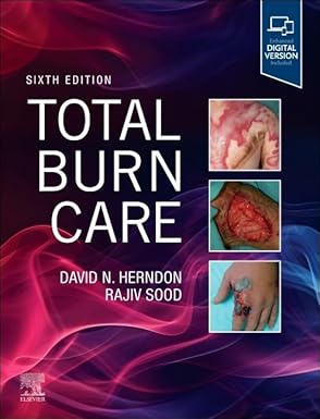 Total Burn Care 6th Edition
