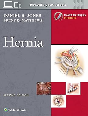 Master Techniques in Surgery: Hernia: Print + eBook with Multimedia Second Edition