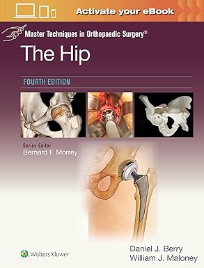Master Techniques in Orthopaedic Surgery: The Hip: Print + eBook with Multimedia Fourth Edition
