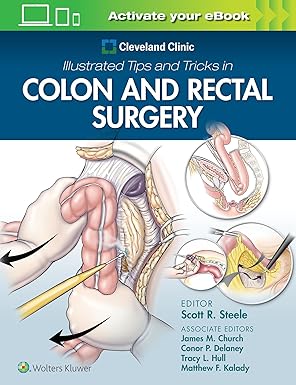 Cleveland Clinic Illustrated Tips and Tricks in Colon and Rectal