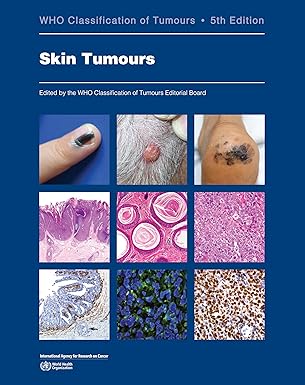 Skin Tumours: WHO Classification of Tumours 5th Edition