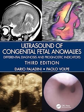 Ultrasound of Congenital Fetal Anomalies: Differential Diagnosis and Prognostic Indicators 3rd Edition