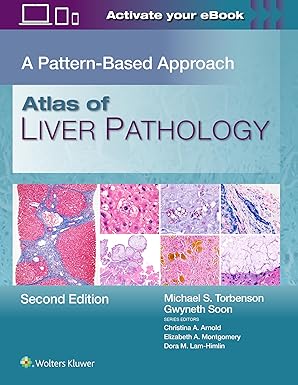Atlas of Liver Pathology: A Pattern-Based Approach Second Edition