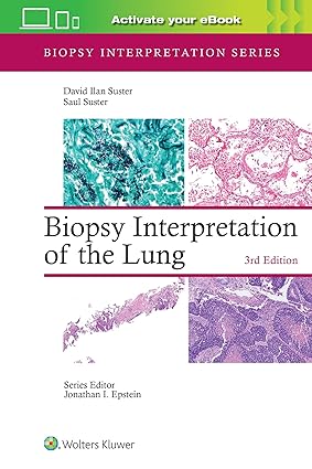 Biopsy Interpretation of the Lung: Print + ebook with Multimedia Third Edition