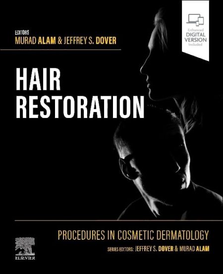 Procedures in Cosmetic Dermatology: Hair Restoration 2024