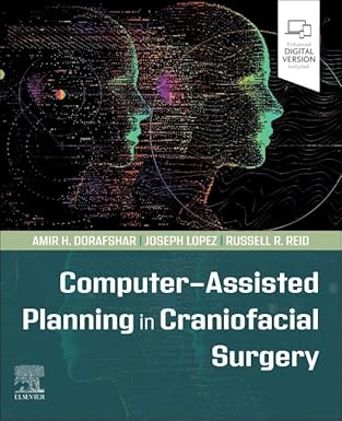 Computer-Assisted Planning in Craniofacial Surgery 2024