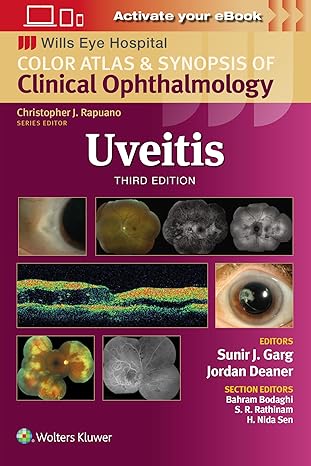 Uveitis (Wills Eye Institute Atlas Series) 3/E 2025