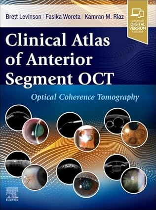 Clinical Atlas of Anterior Segment OCT: Optical Coherence Tomography 2025