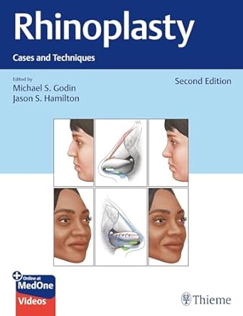 Rhinoplasty: Cases and Techniques 2/E 2025